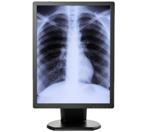 Double Black Imaging 3MP Monochrome Diagnostic Display Double Black Imaging 3MP Monochrome Diagnostic Display