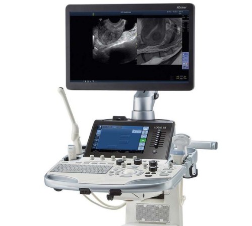 GE Healthcare Logiq S8 GE Healthcare Logiq S8