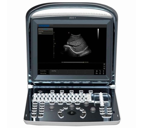 Chison SonoTouch 10 Chison SonoTouch 10