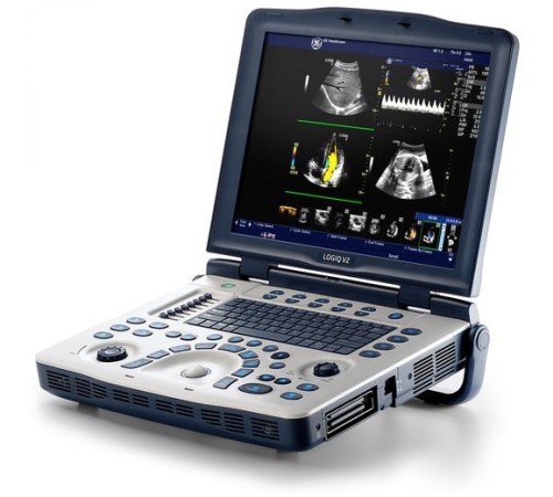 GE Healthcare Logiq V2 GE Healthcare Logiq V2
